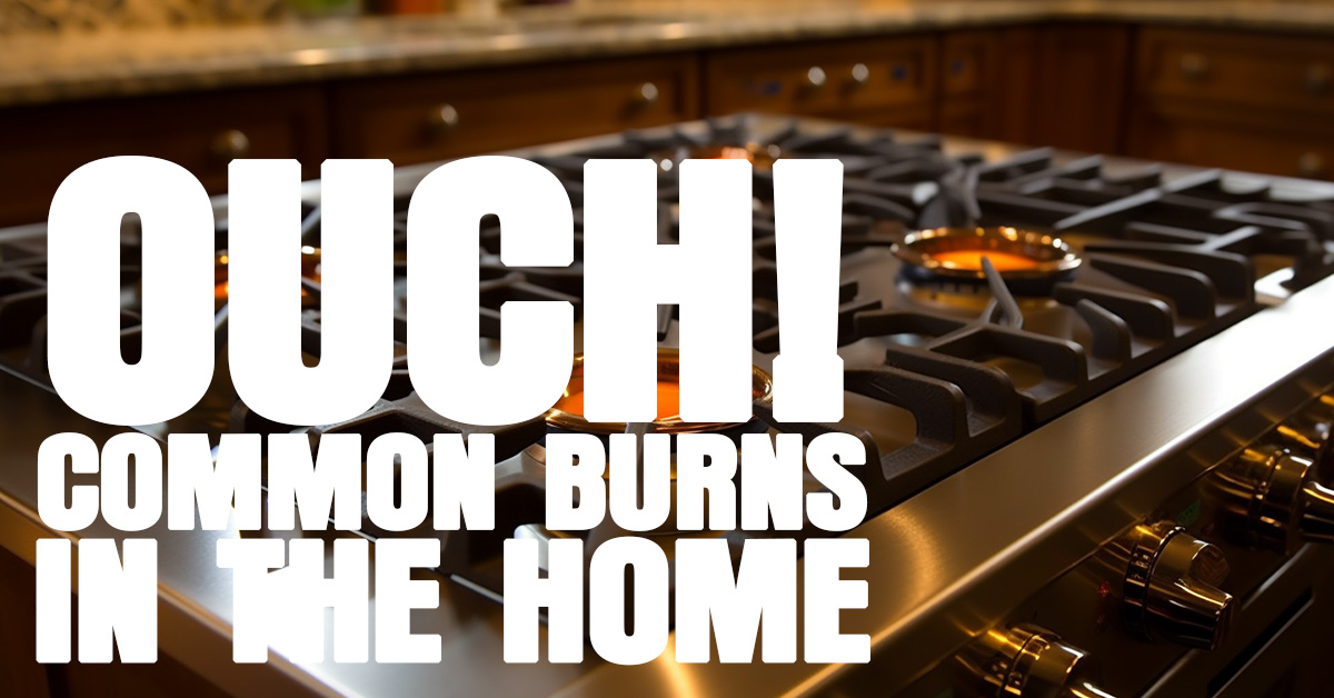 HOME- Ouch! Common Burns in the Home